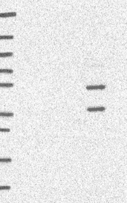 E4F1 Antibody, Novus Biologicals:Antibodies:Primary Antibodies