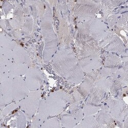 Phospholipase C beta 2 Antibody, Novus Biologicals:Antibodies:Primary Antibodies