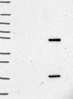 Carm1 Antibody, Novus Biologicals 25 &mu;g; Unconjugated:Antibodies, Polyclonal