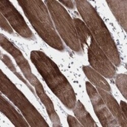 Carm1 Antibody, Novus Biologicals 25 &mu;g; Unconjugated:Antibodies, Polyclonal