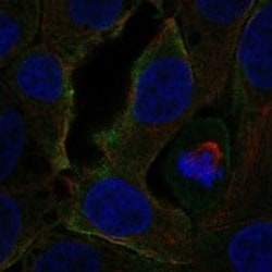 CCR3 Antibody, Novus Biologicals:Antibodies:Primary Antibodies