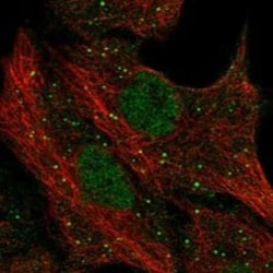 PGLYRP1/PGRP-S Antibody, Novus Biologicals 25 &mu;g; Unconjugated:Antibodies,