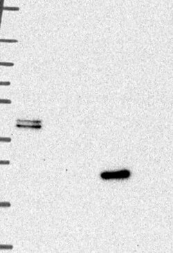Cathepsin L Antibody, Novus Biologicals 25 &mu;g; Unconjugated:Antibodies,