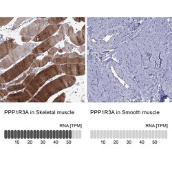 PPP1R3A Antibody, Novus Biologicals:Antibodies:Primary Antibodies