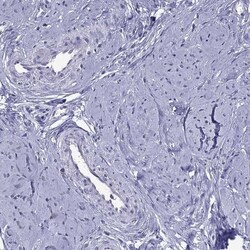 PPP1R3A Antibody, Novus Biologicals:Antibodies:Primary Antibodies