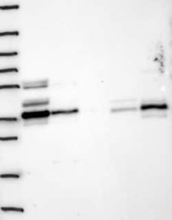 RPRD1B Antibody, Novus Biologicals:Antibodies:Primary Antibodies