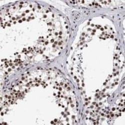 RPRD1B Antibody, Novus Biologicals:Antibodies:Primary Antibodies