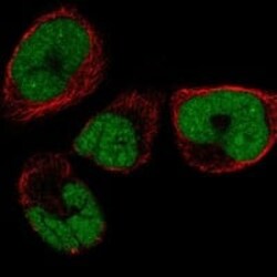 SMNDC1 Antibody, Novus Biologicals 25 &mu;g; Unconjugated:Antibodies, Polyclonal