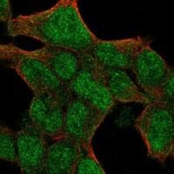 Pin1 Antibody, Novus Biologicals 25 &mu;g; Unconjugated:Antibodies, Polyclonal