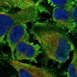 SNAP25 Antibody, Novus Biologicals 25 &mu;g; Unconjugated:Antibodies, Polyclonal