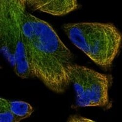 Dynactin Subunit 1/DCTN1 Antibody, Novus Biologicals 25 &mu;g; Unconjugated:Antibodies,