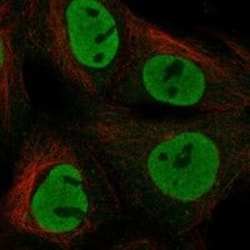Nanog Antibody, Novus Biologicals 25 &mu;g; Unconjugated:Antibodies, Polyclonal