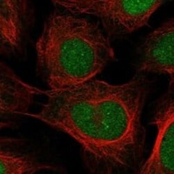 Neurogenin-1 Antibody, Novus Biologicals 25 &mu;g; Unconjugated:Antibodies,