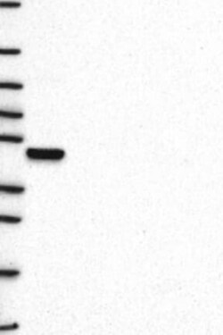 TDAG8/GPR65 Antibody, Novus Biologicals 100 &mu;L; Unconjugated:Antibodies,