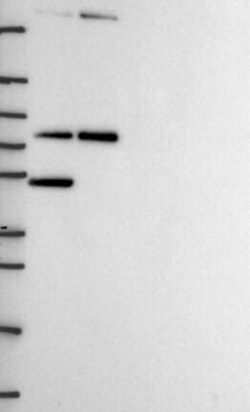 MTA2 Antibody, Novus Biologicals 25 &mu;L; Unconjugated:Antibodies, Polyclonal