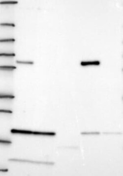 ALDH4A1 Antibody, Novus Biologicals 100 &mu;L; Unconjugated:Antibodies,