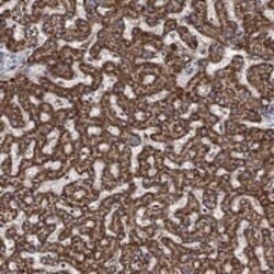 ALDH4A1 Antibody, Novus Biologicals 100 &mu;L; Unconjugated:Antibodies,