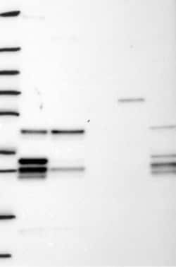 PCBP2 Antibody, Novus Biologicals:Antibodies:Primary Antibodies