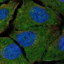 LAP (TGF-beta 1) Antibody, Novus Biologicals 100 &mu;L; Unconjugated:Antibodies,