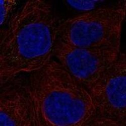 IL-27R alpha/WSX-1/TCCR Antibody, Novus Biologicals 25 &mu;L; Unconjugated:Antibodies,