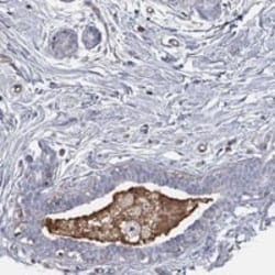 IFN-beta Antibody, Novus Biologicals:Antibodies:Primary Antibodies