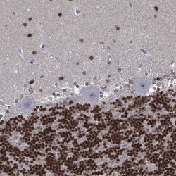 ZNF238 Antibody, Novus Biologicals 25 &mu;g; Unconjugated:Antikörper