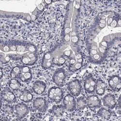 ZNF238 Antibody, Novus Biologicals 25 &mu;g; Unconjugated:Antikörper