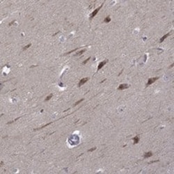 beta-1,3-Glucuronyltransferase 1/B3GAT1 Antibody, Novus Biologicals:Antibodies:Primary