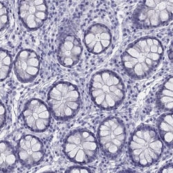 TRPM3 Antibody, Novus Biologicals:Antibodies:Primary Antibodies