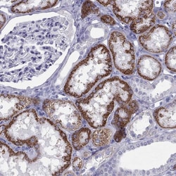 TRPM3 Antibody, Novus Biologicals:Antibodies:Primary Antibodies