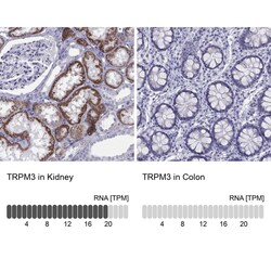 TRPM3 Antibody, Novus Biologicals:Antibodies:Primary Antibodies