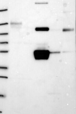 Fibrinogen gamma chain Antibody, Novus Biologicals 25 &mu;g; Unconjugated:Antibodies,