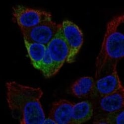Fibrinogen gamma chain Antibody, Novus Biologicals 25 &mu;g; Unconjugated:Antibodies,