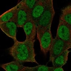 Pygopus-2 Antibody, Novus Biologicals 100 &mu;g; Unconjugated:Antibodies,