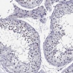 DOT1L Antibody, Novus Biologicals 100 &mu;g; Unconjugated:Antibodies, Polyclonal