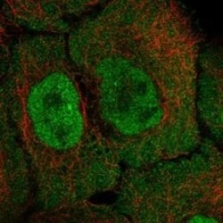ADK Antibody, Novus Biologicals 100 &mu;g; Unconjugated:Antibodies, Polyclonal