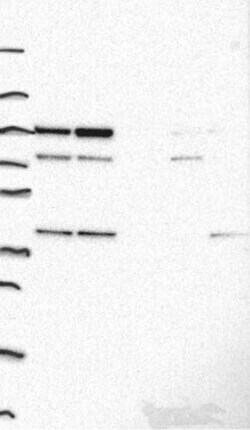 ADK Antibody, Novus Biologicals 100 &mu;g; Unconjugated:Antibodies, Polyclonal