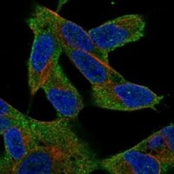 TAK1 Antibody, Novus Biologicals 100 &mu;g; Unconjugated:Antibodies, Polyclonal
