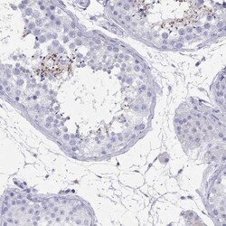 ARMC12 Antibody, Novus Biologicals:Antibodies:Primary Antibodies