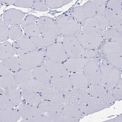 ARMC12 Antibody, Novus Biologicals:Antibodies:Primary Antibodies