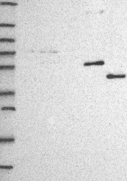 CYP3A7 Antibody, Novus Biologicals 100 &mu;g; Unconjugated:Antibodies,