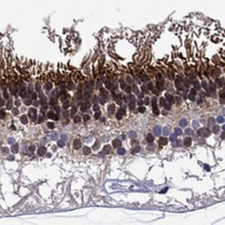Musashi-1 Antibody, Novus Biologicals:Antibodies:Primary Antibodies