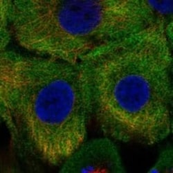 Calpastatin Antibody, Novus Biologicals:Antibodies:Primary Antibodies