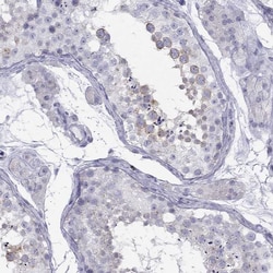 TDRD6 Antibody, Novus Biologicals 100 &mu;g; Unconjugated:Antibodies, Polyclonal