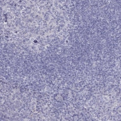 TDRD6 Antibody, Novus Biologicals 100 &mu;g; Unconjugated:Antibodies, Polyclonal