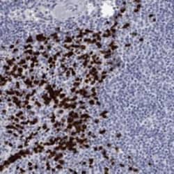 IRF5 Antibody, Novus Biologicals 100 &mu;g; Unconjugated:Antibodies, Polyclonal