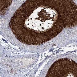 MTHFR Antibody, Novus Biologicals:Antibodies:Primary Antibodies