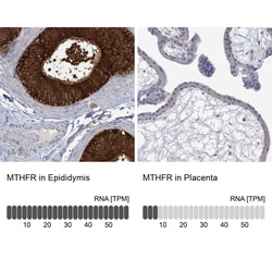 MTHFR Antibody, Novus Biologicals:Antibodies:Primary Antibodies