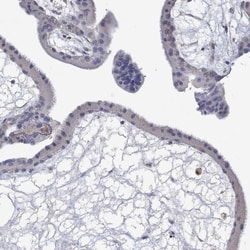 MTHFR Antibody, Novus Biologicals:Antibodies:Primary Antibodies