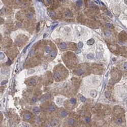 MTHFR Antibody, Novus Biologicals:Antibodies:Primary Antibodies